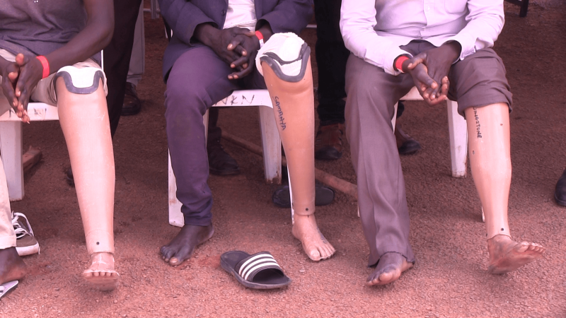 Rise in Amputations and Disabilities Reported in Uganda